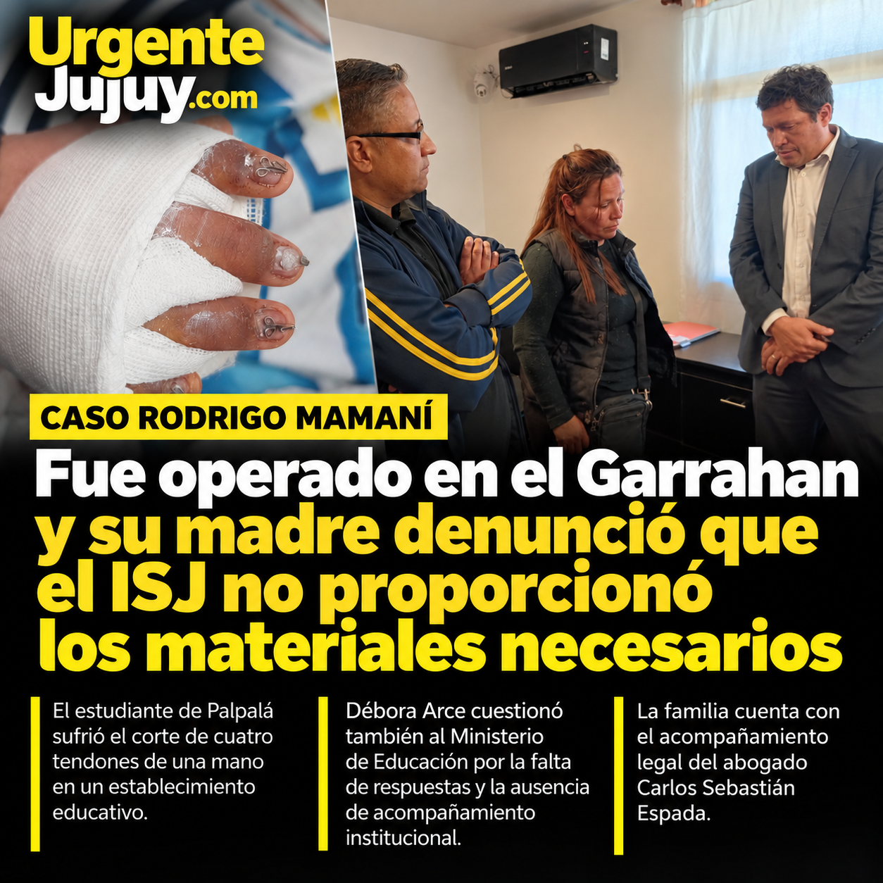 Rodrigo Mamaní fue operado en el Garrahan y su madre denunció que el ISJ no proporcionó los materiales necesarios
